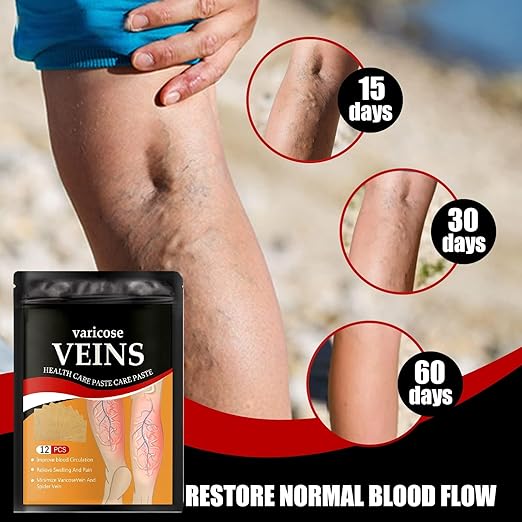 Varicose Veins Sticker for Legs, Against Spider Veins Patch(PACK 1)